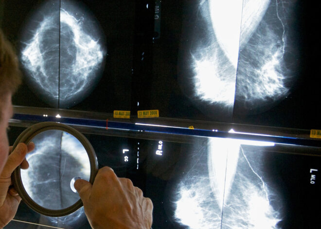 When should you get a mammogram? Conflicting advice makes it hard to know