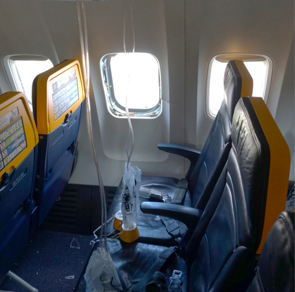 Broken engine parts shattered the Ryanair plane window that a man’s head got sucked into: NTSB
